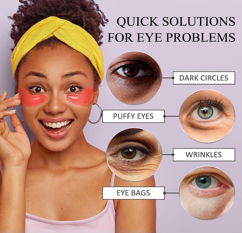 How to Get Rid of Puffy Eyes and Dark Circles 